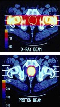 Comparison of Energy Deposited at Tumors